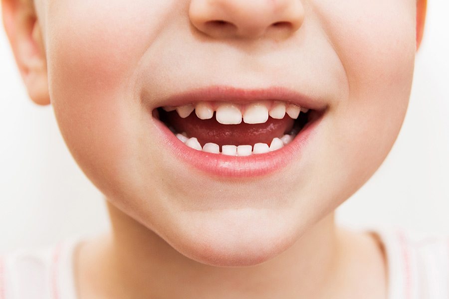 childs teeth