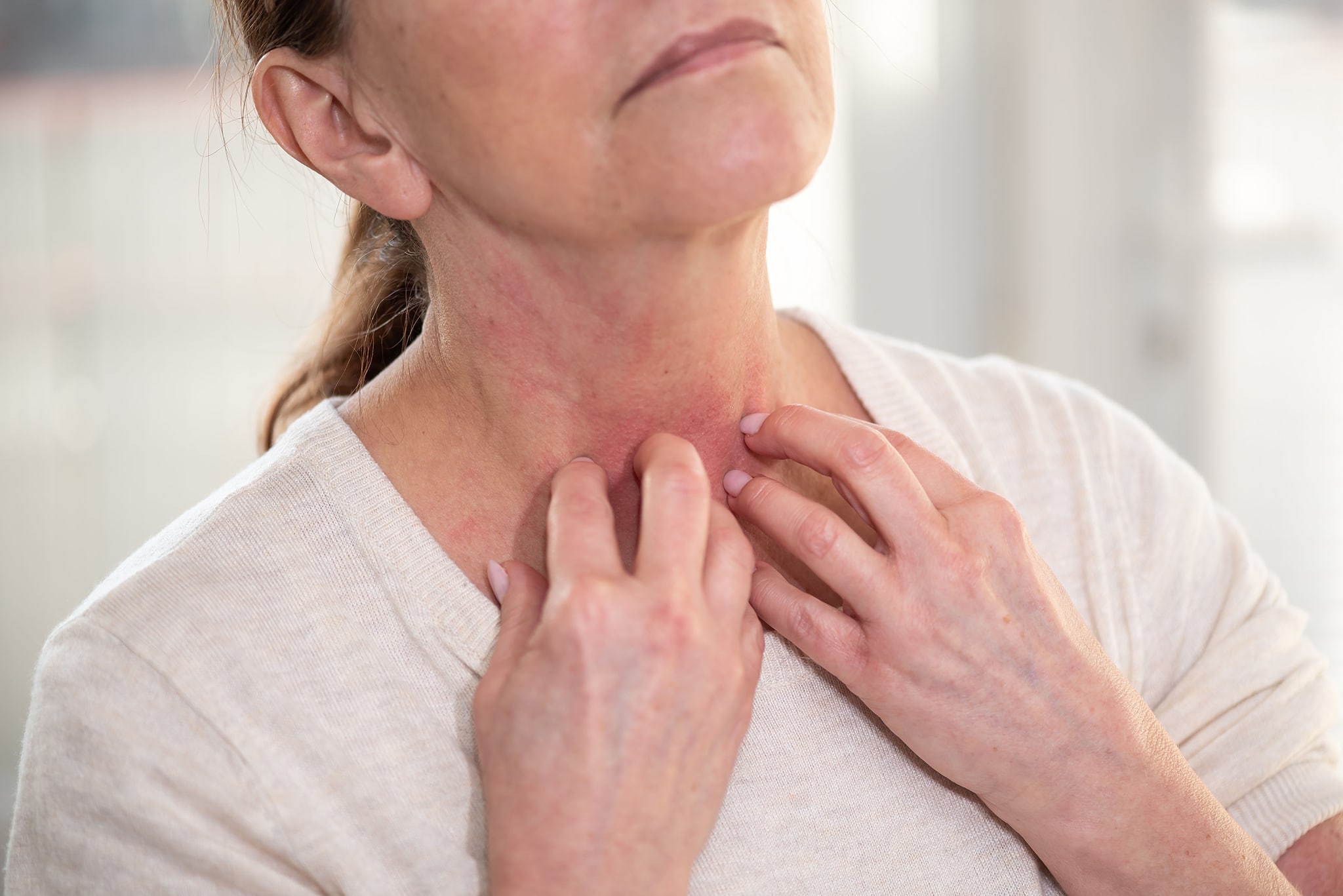 Did you know Itchy Skin can be a Symptom of Menopause? MenoMe®